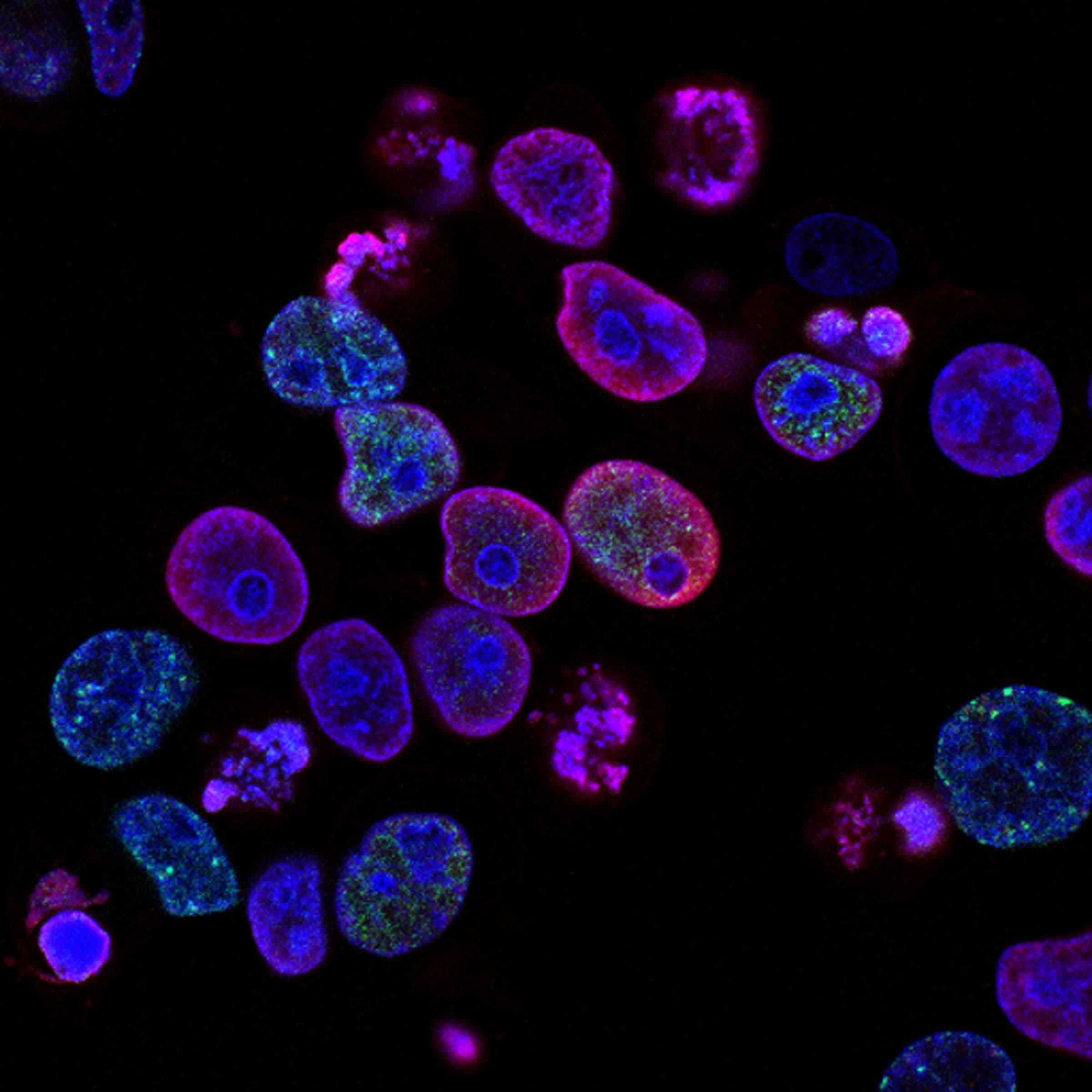 Fluorescence microscopy of stained cell nuclei