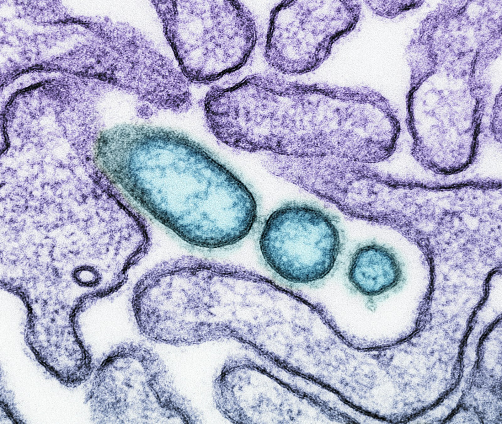 Colorized electron micrograph of viral particles at a cell membrane